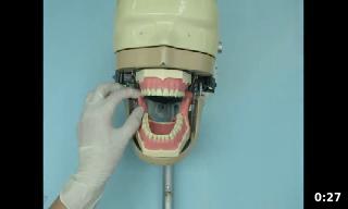 La técnica indirecta del bloqueo mandibular consiste en introducir la aguja desde p